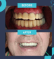 Slider image (9) Dr. Aleksandar Kovacevic - Dental Clinic in Croatia